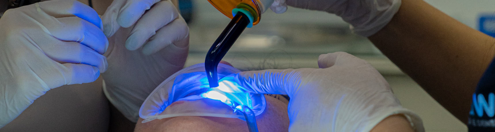 Qual é o preço de fazer um branqueamento dentário em Portugal?