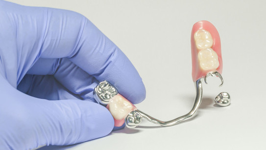 Tudo sobre o uso de Prótese Dentária Removível: quais os diferentes tipos e quanto tempo dura?